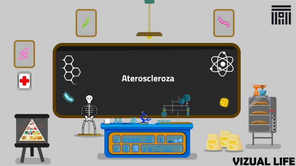 Ateroscleroza